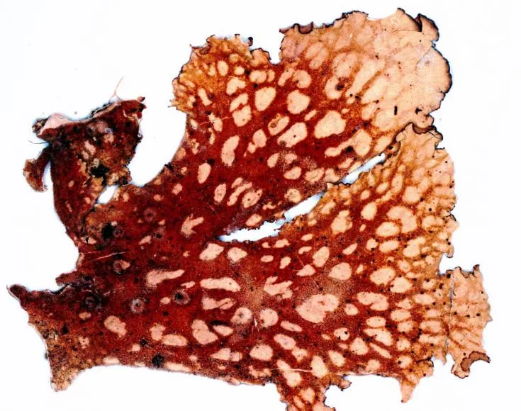 Yoshimuriella fendleri (Yoshimuriella fendleri) — photo mycologique